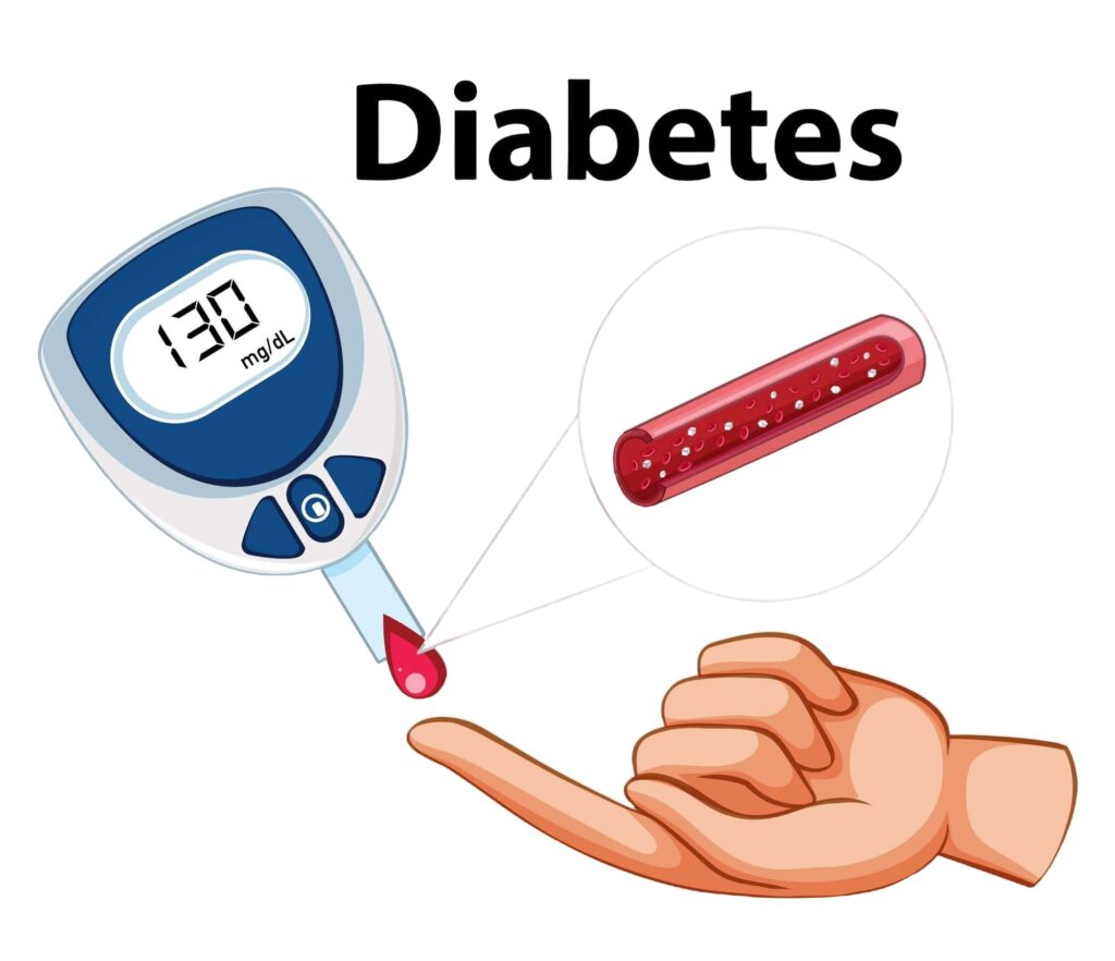 Diabetes Specialist - Pinellas Park, Tampa, & St. Petersburg, Florida