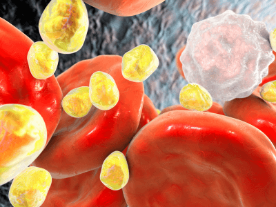 Common Myths About Cholesterol and Lipid Disorders – Busted! | Florida Endocrinology