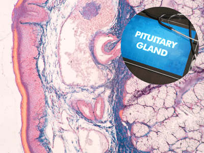 Early Warning Signs of a Pituitary Disorder You Shouldn’t Ignore | Florida Endocrinology