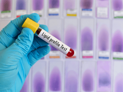 Genetics vs. Lifestyle: What Really Causes Lipid Disorders? | Florida Endocrinology