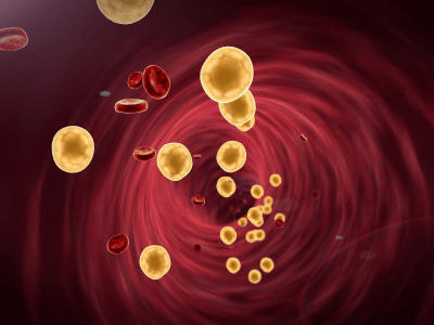 Understanding the Difference Between Good and Bad Cholesterol | Florida Endocrinology