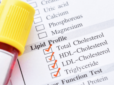 How to Get Your Cholesterol Tested | Florida Endocrinology