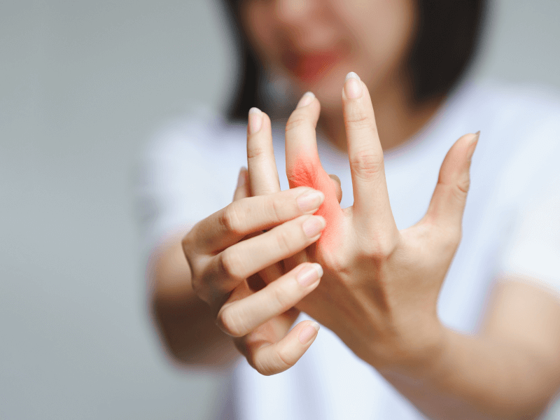 6 common types of arthritis and related conditions Florida Endocrinology