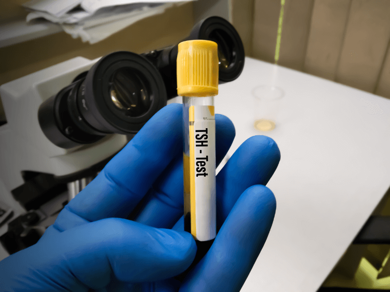 TSH (Thyroid-Stimulating Hormone) Levels Symptoms Florida Endocrinology