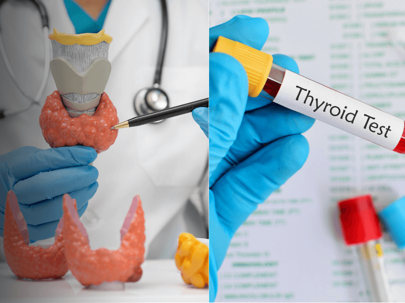 Understanding Your Thyroid Lab Results What do TSH, T3, and T4 Really Mean Florida Endocrinology