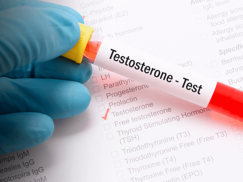 Low Testosterone Is it Just Aging, or Something More? Florida Endocrinology
