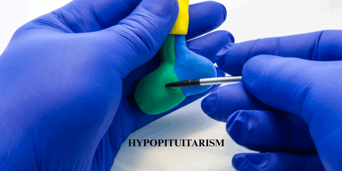 Hypopituitarism What You Need to Know tampabayendocrine