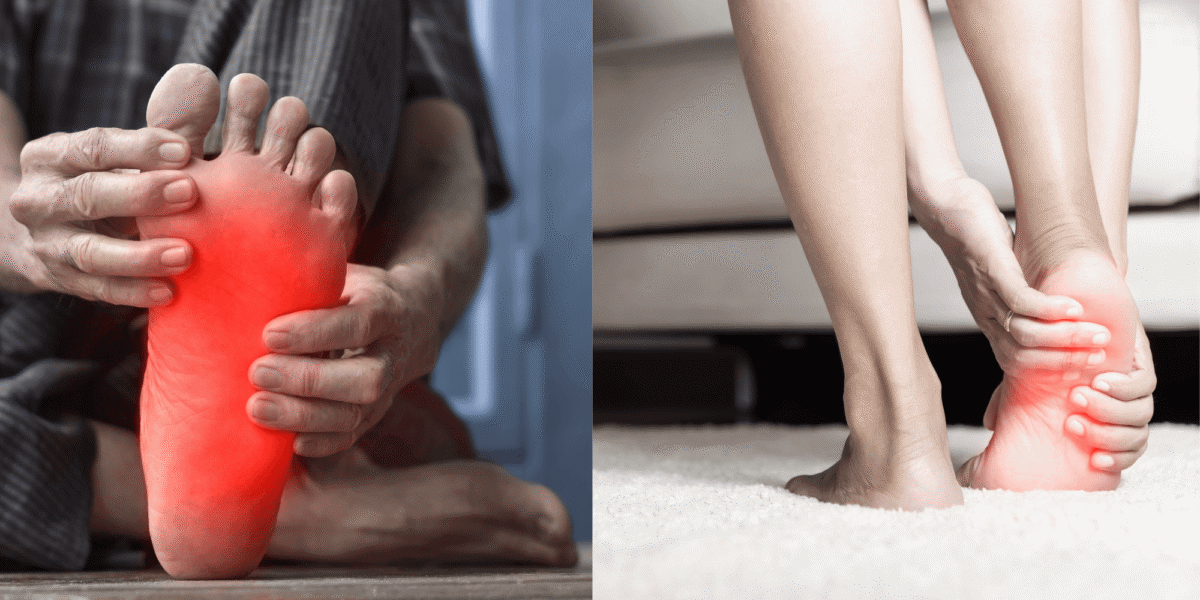Diabetic Neuropathy
